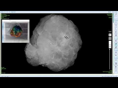 youtube - [Video]